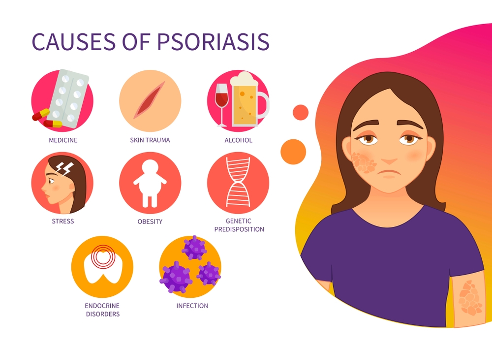 Causes of Psoriasis